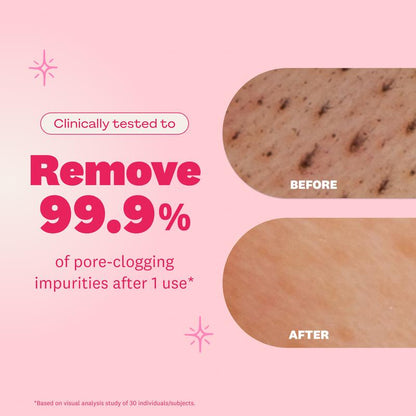 Soralise™ Jabón Iluminador Facial