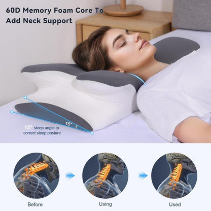 Soralise™ CerviComfort
