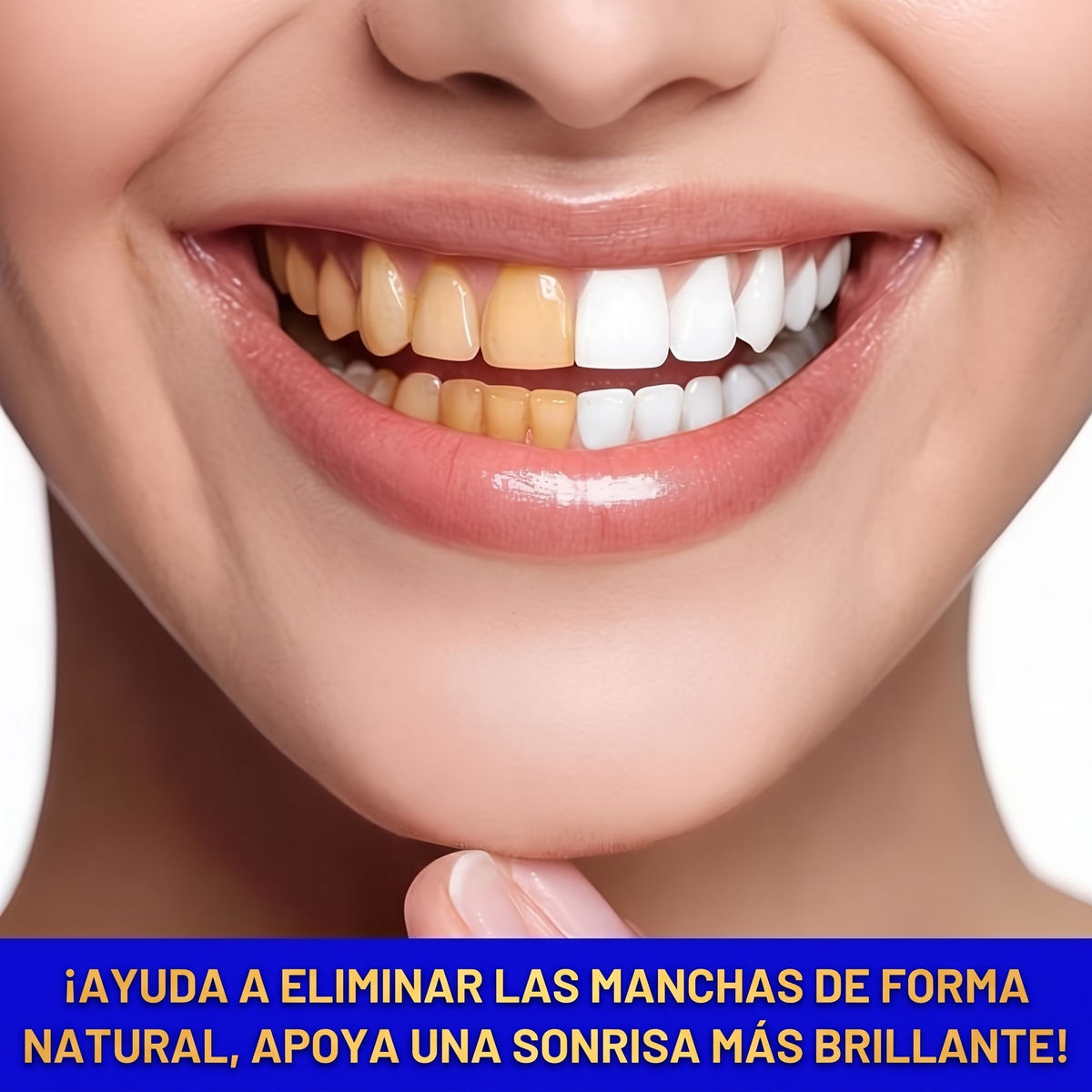 Soralise™ Chicle Dental FreshWhite